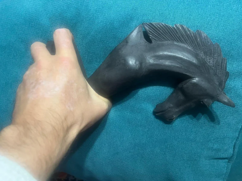 Sebastian's hand with vitiligo patches resting beside a carved dark wooden horse head on a teal sofa
