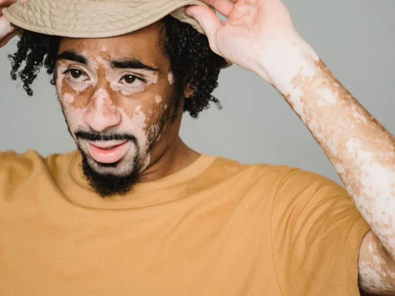 Portrait of a confident man with vitiligo wearing a yellow T-shirt and hat